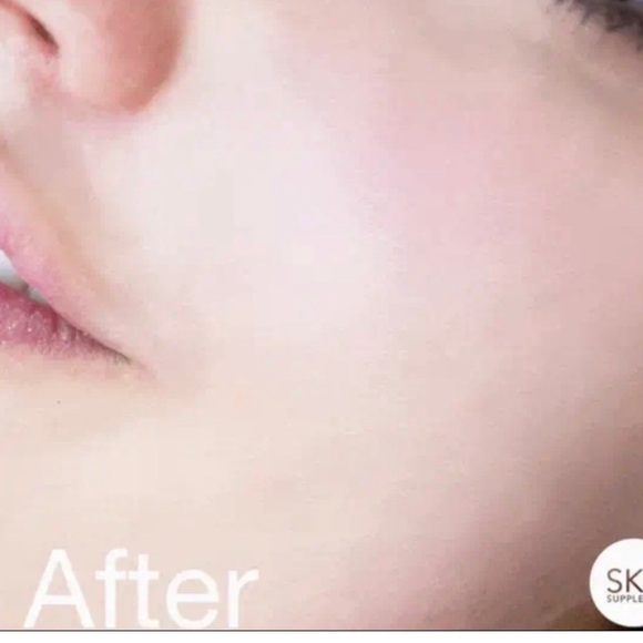 SKIN INC. ~ Serum Glow Filter Hydra Micro Capsule ~ 1 fl oz Full Size ~ New - Picture 7 of 9